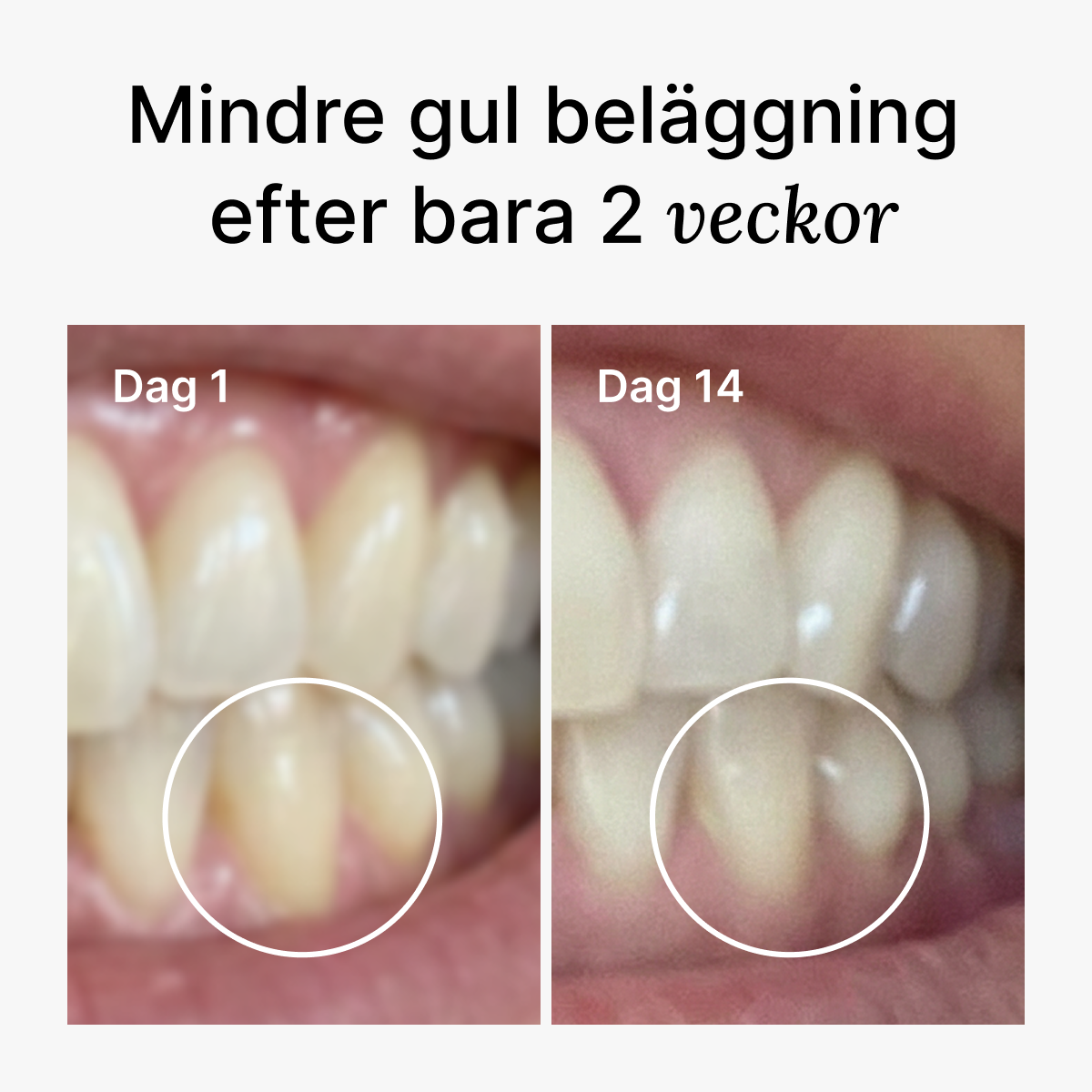 D2 Pro Elektrisk Tandborste